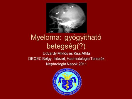 Myeloma: gyógyitható betegség(?)