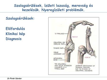 Szalagsérülések: Előfordulás Klinikai kép Diagnosis