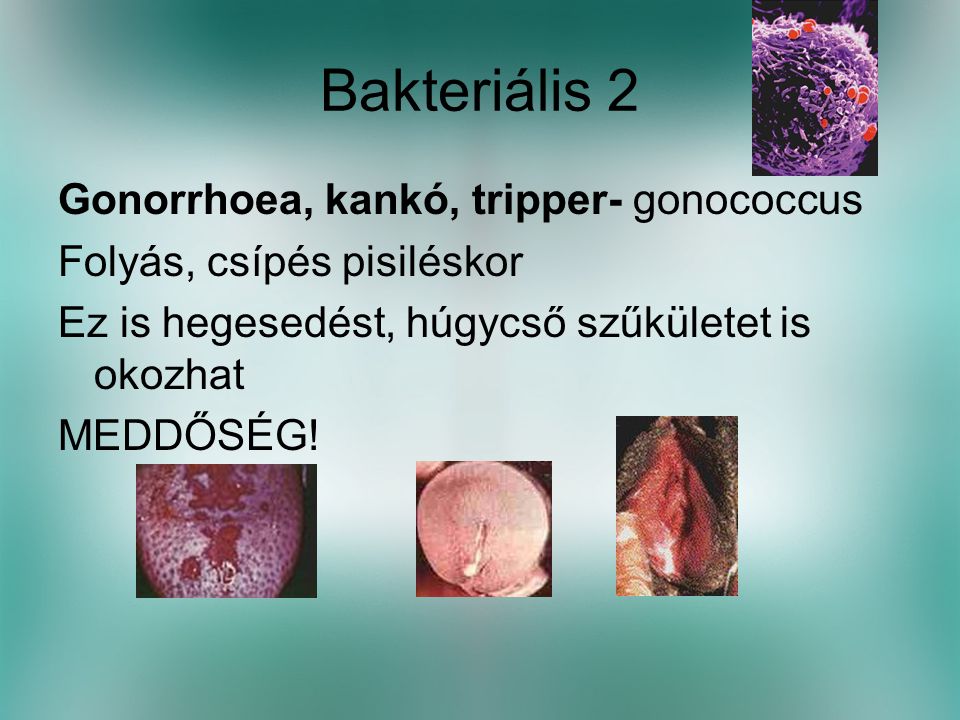 Bakteriális 2 Gonorrhoea, kankó, tripper- gonococcus