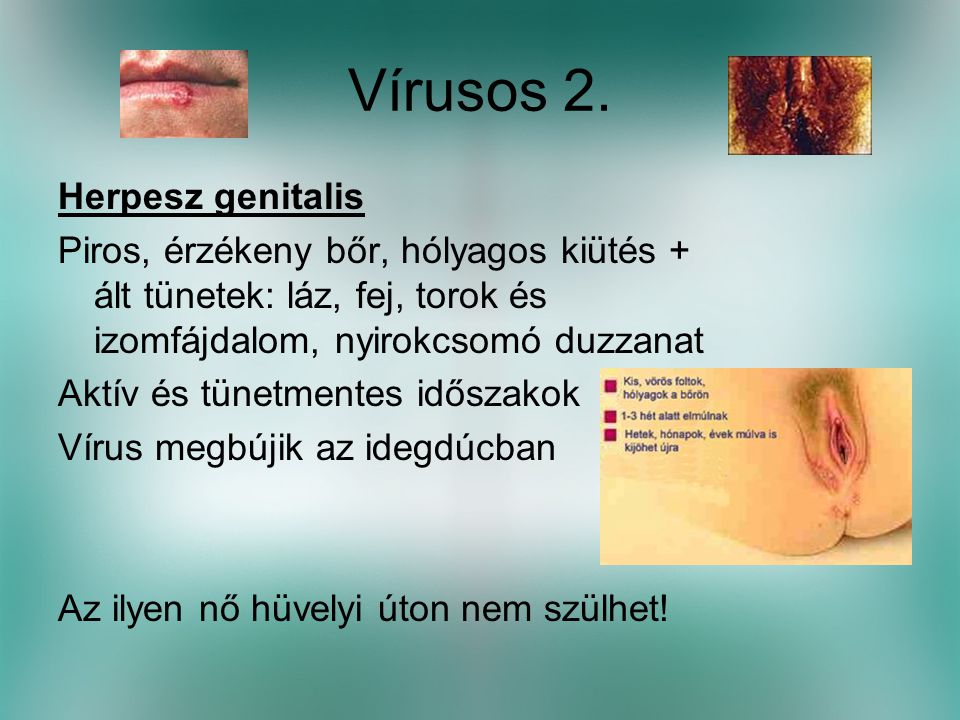 Vírusos 2. Herpesz genitalis