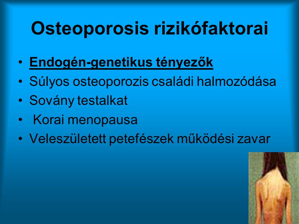 Osteoporosis rizikófaktorai