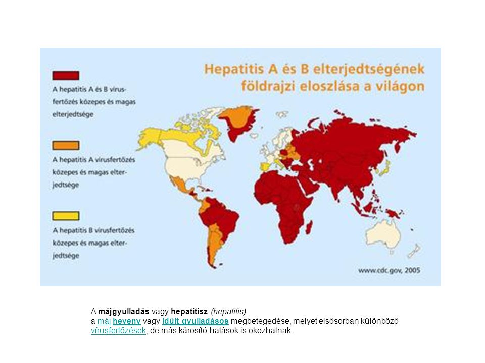 A májgyulladás vagy hepatitisz (hepatitis)