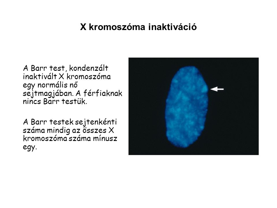 X kromoszóma inaktiváció