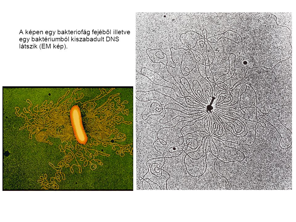 A képen egy bakteriofág fejéből illetve egy baktériumból kiszabadult DNS látszik (EM kép).