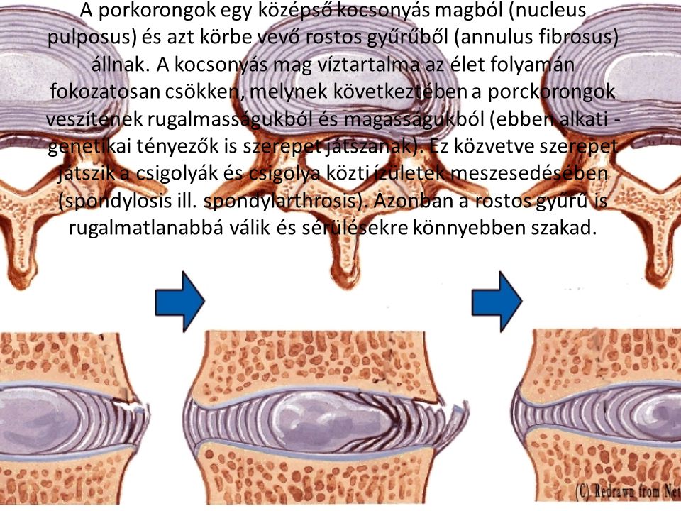 A porkorongok egy középső kocsonyás magból (nucleus pulposus) és azt körbe vevő rostos gyűrűből (annulus fibrosus) állnak.