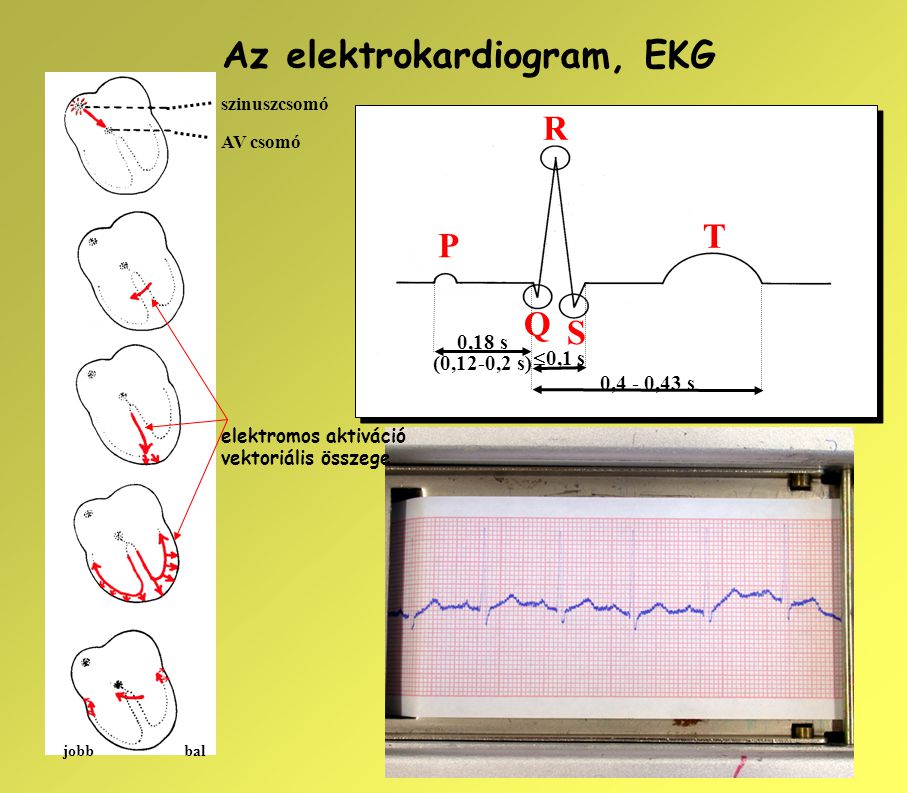 Az elektrokardiogram, EKG