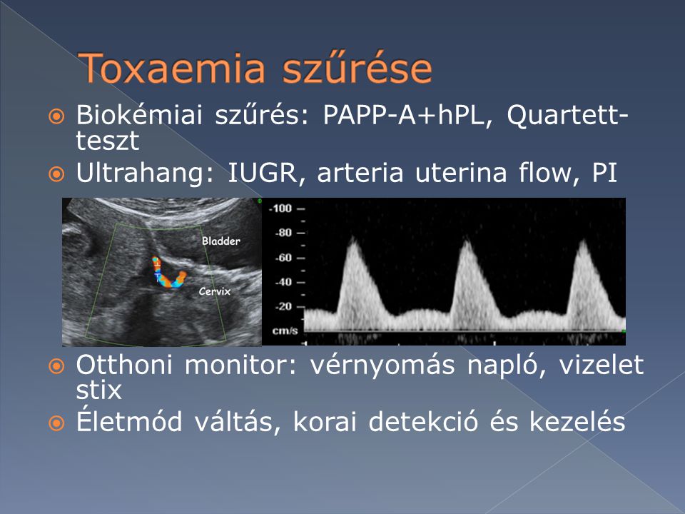 Toxaemia szűrése Biokémiai szűrés: PAPP-A+hPL, Quartett-teszt