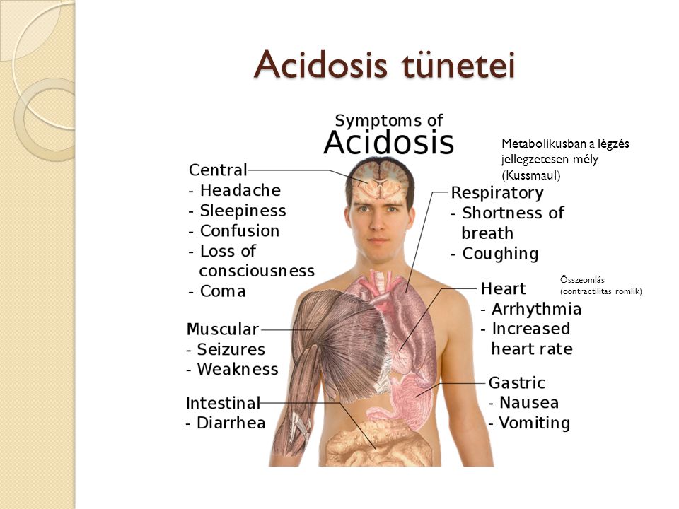 Acidosis tünetei Metabolikusban a légzés jellegzetesen mély (Kussmaul)