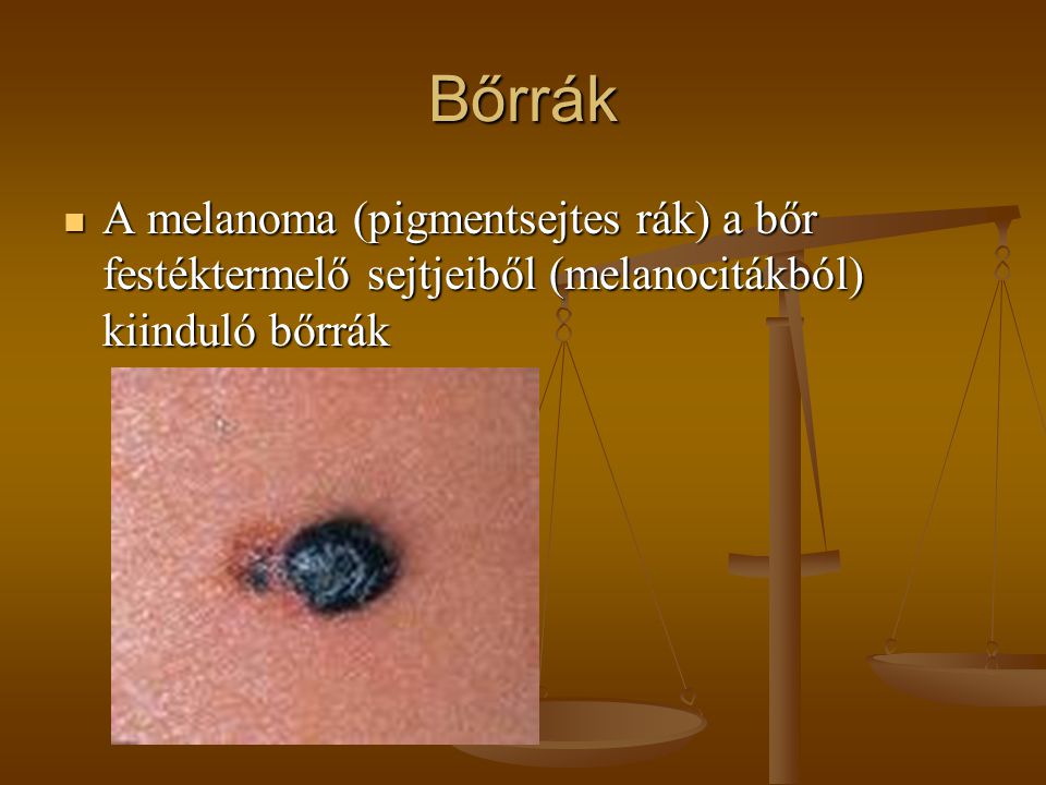 Bőrrák A melanoma (pigmentsejtes rák) a bőr festéktermelő sejtjeiből (melanocitákból) kiinduló bőrrák.