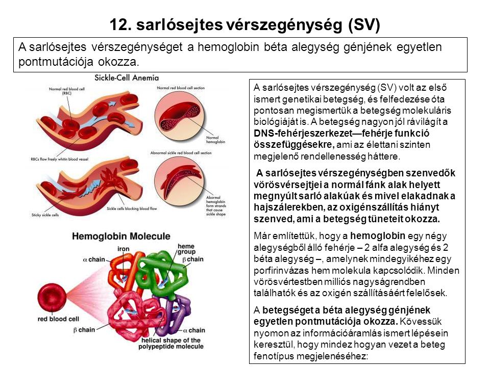 12. sarlósejtes vérszegénység (SV)
