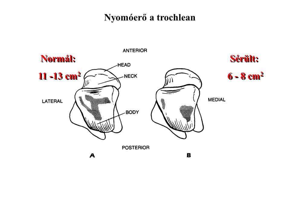 Nyomóerő a trochlean Normál: cm2 Sérült: cm2
