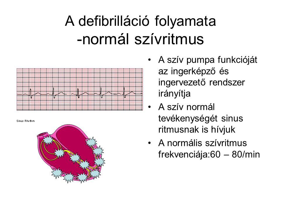 A defibrilláció folyamata -normál szívritmus