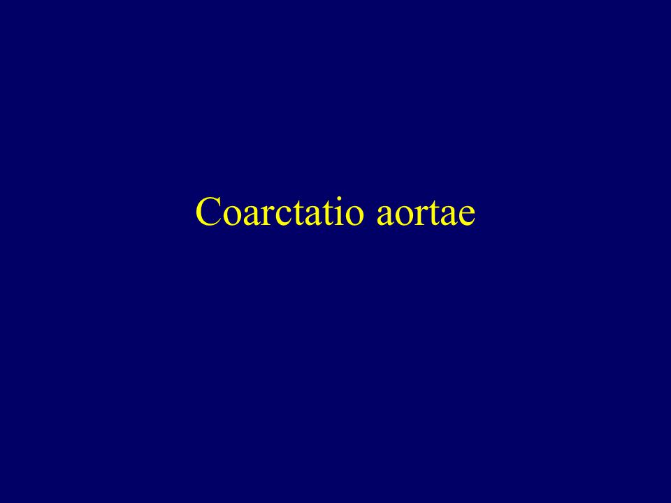Coarctatio aortae