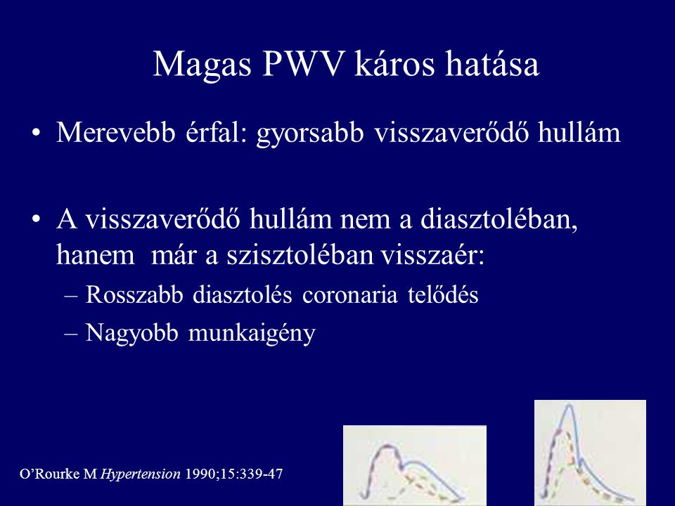 Magas PWV káros hatása Merevebb érfal: gyorsabb visszaverődő hullám
