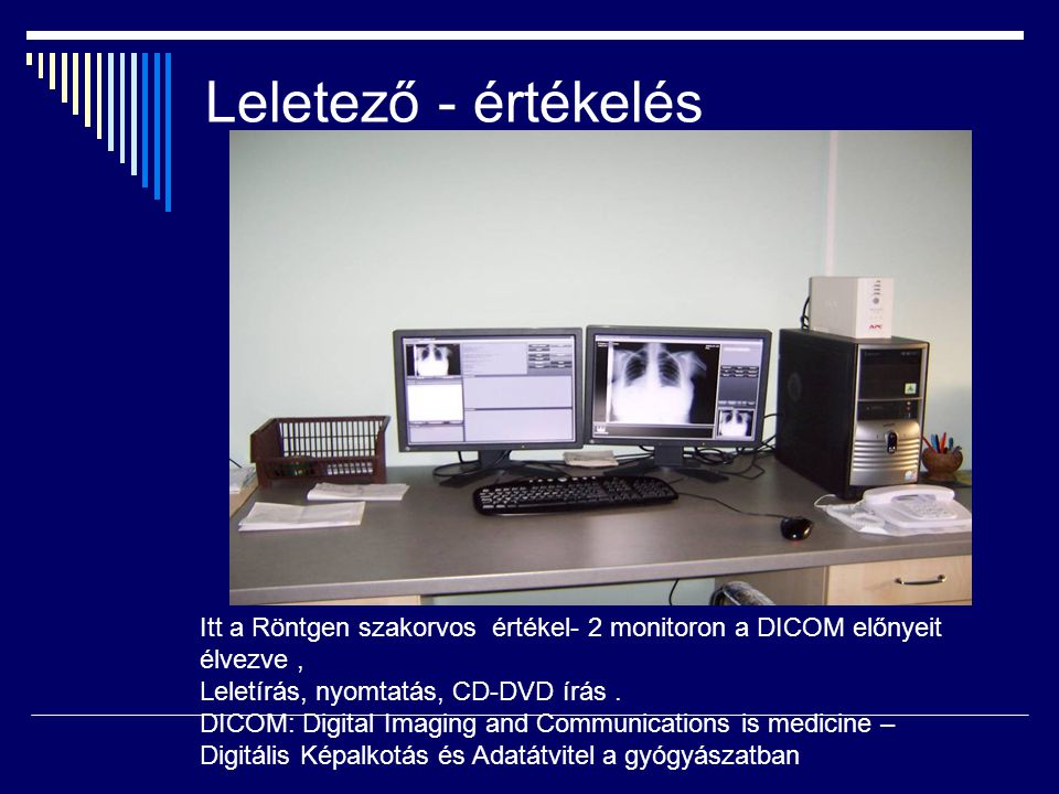 Leletező - értékelés Itt a Röntgen szakorvos értékel- 2 monitoron a DICOM előnyeit élvezve , Leletírás, nyomtatás, CD-DVD írás .