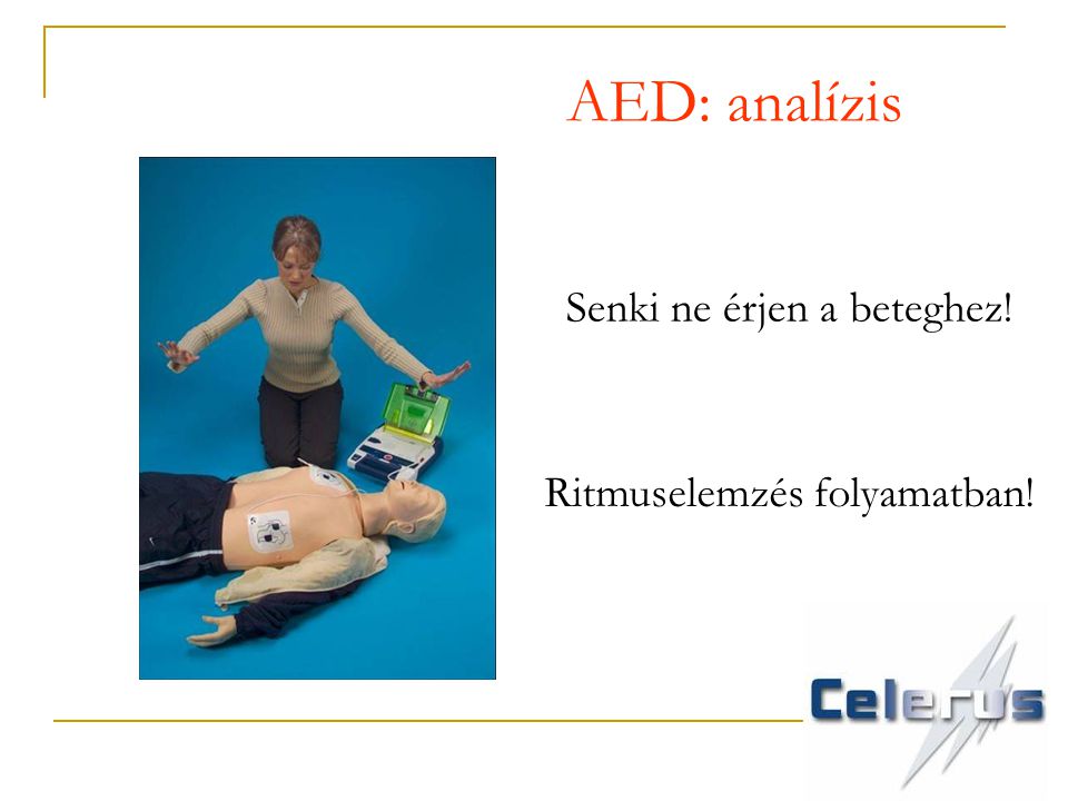 AED: analízis Senki ne érjen a beteghez! Ritmuselemzés folyamatban!