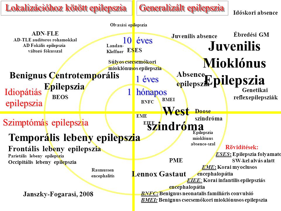 Juvenilis Mioklónus Epilepszia