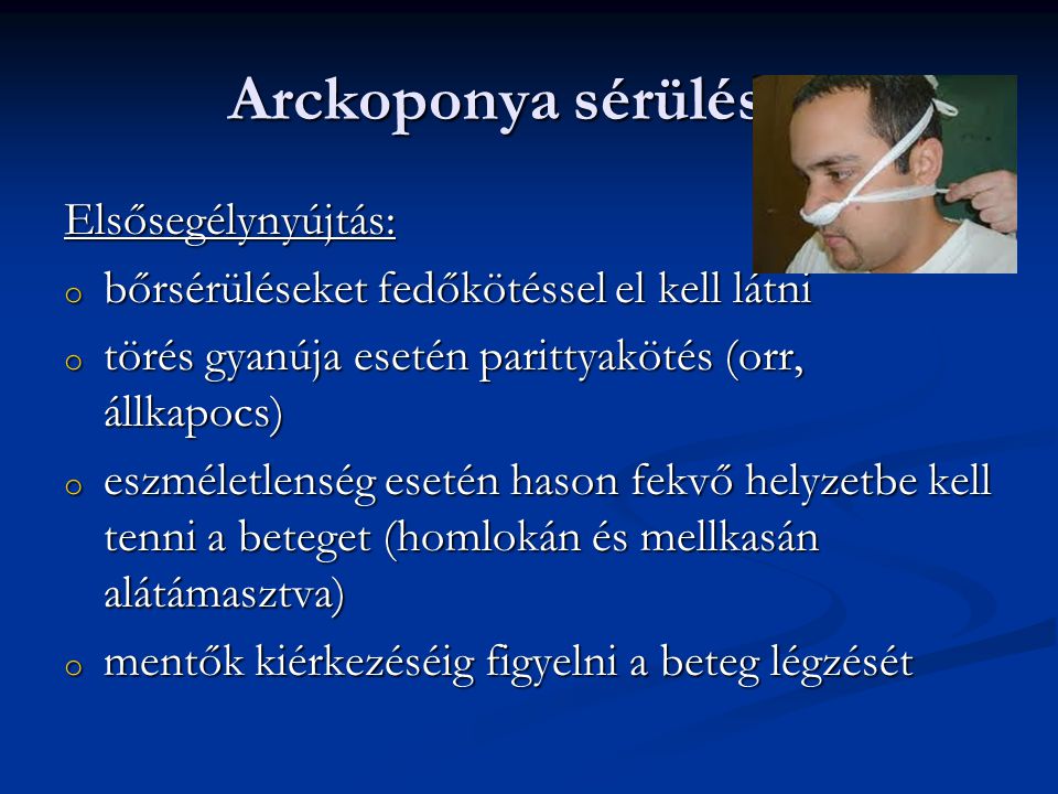 Arckoponya sérülések Elsősegélynyújtás: