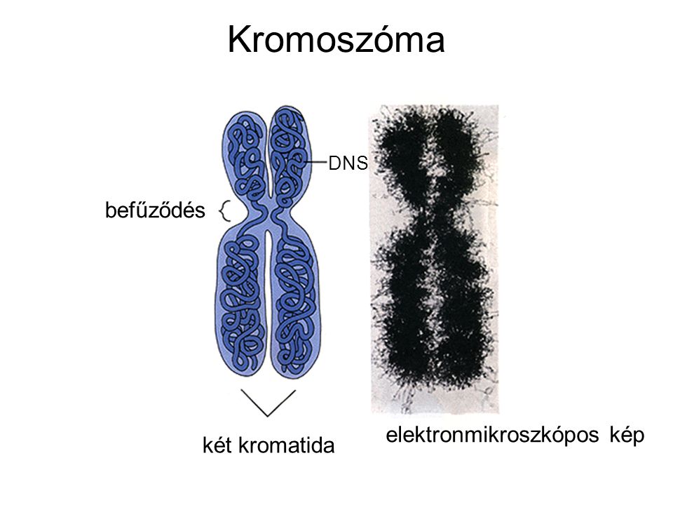 Kromoszóma DNS befűződés elektronmikroszkópos kép két kromatida