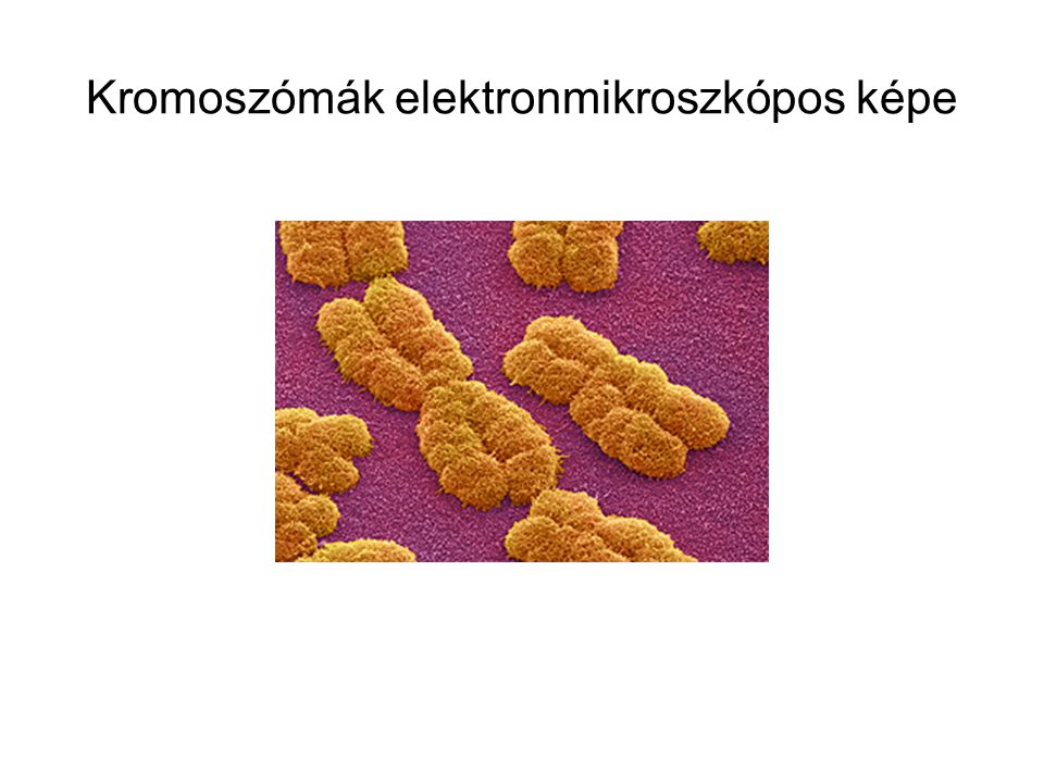 Kromoszómák elektronmikroszkópos képe