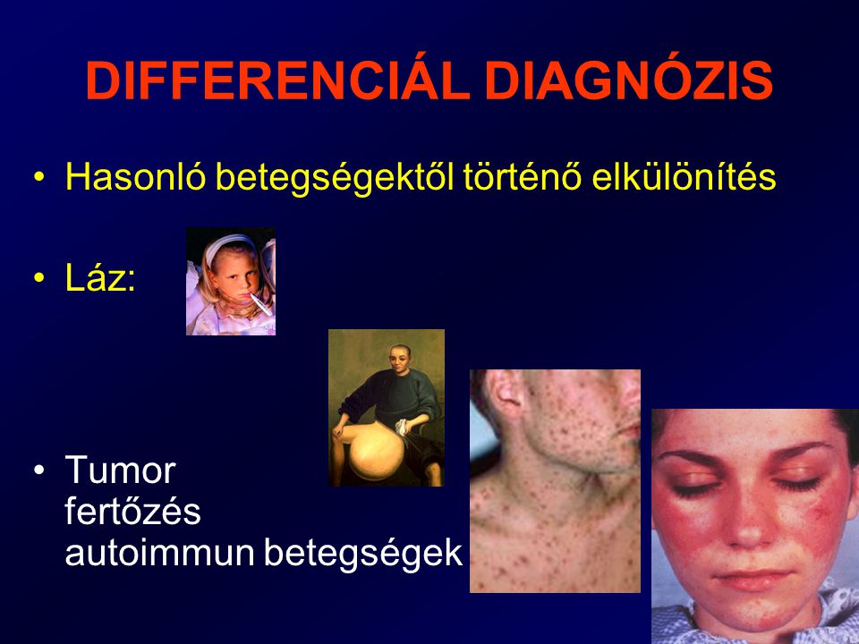 DIFFERENCIÁL DIAGNÓZIS