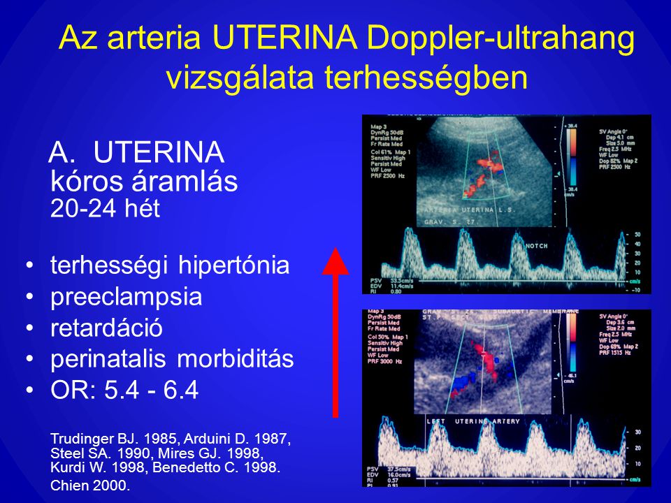 Az arteria UTERINA Doppler-ultrahang vizsgálata terhességben