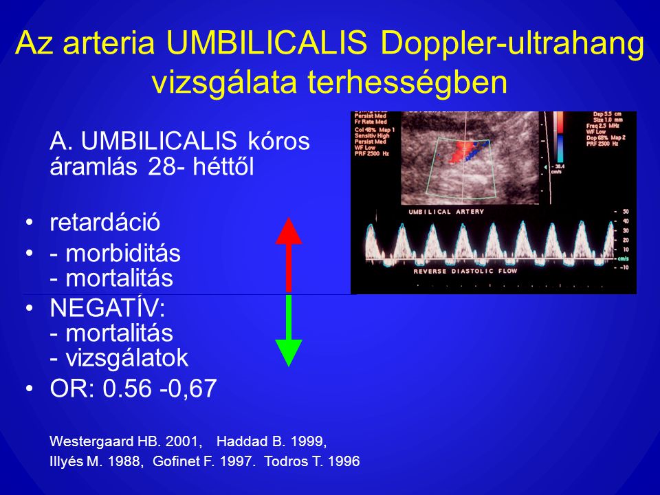 Az arteria UMBILICALIS Doppler-ultrahang vizsgálata terhességben