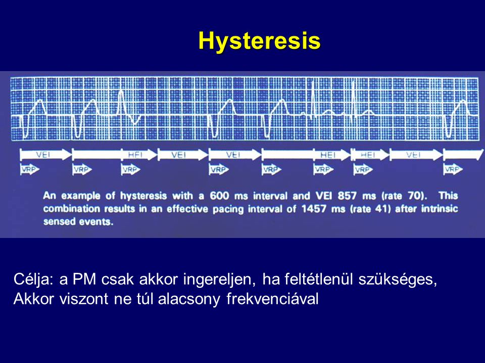 Hysteresis Célja: a PM csak akkor ingereljen, ha feltétlenül szükséges, Akkor viszont ne túl alacsony frekvenciával.
