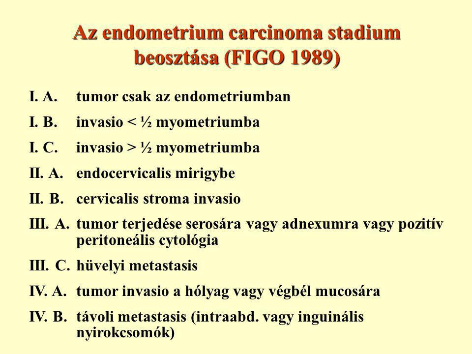Az endometrium carcinoma stadium beosztása (FIGO 1989)