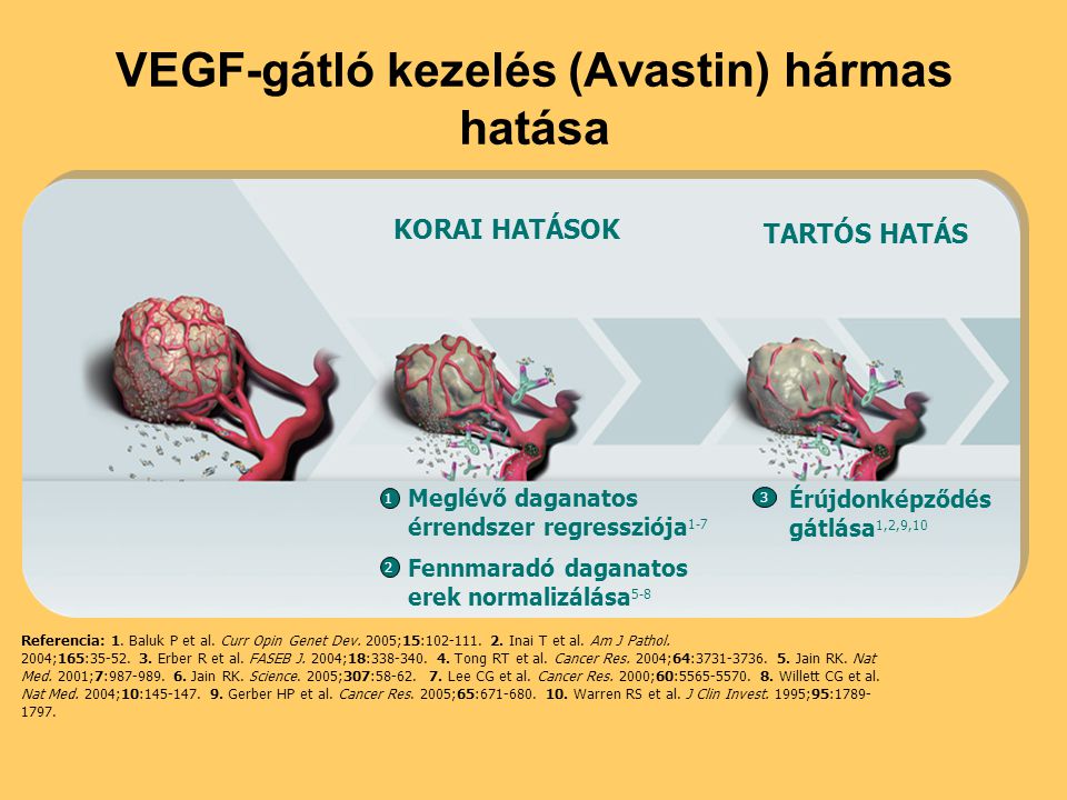 VEGF-gátló kezelés (Avastin) hármas hatása