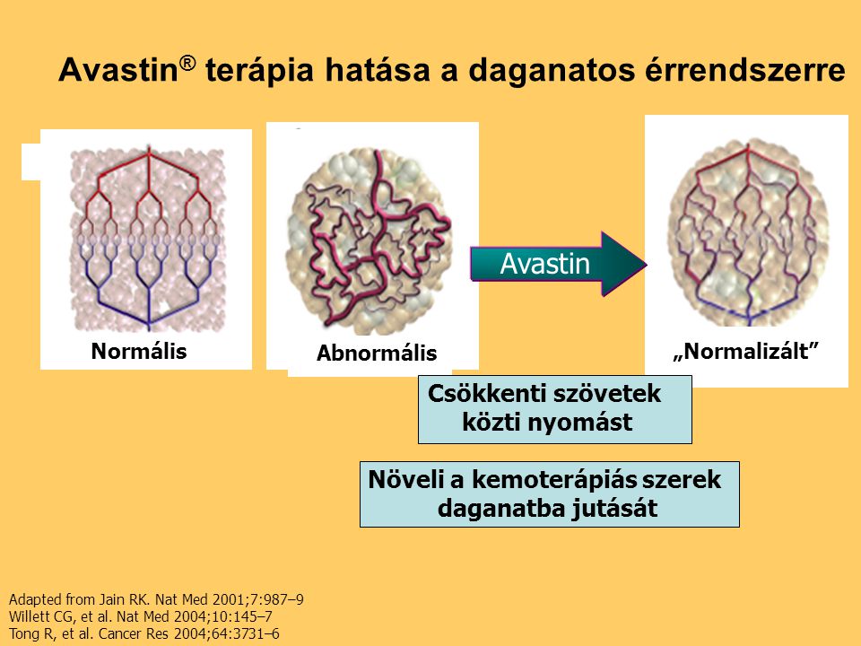 Avastin® terápia hatása a daganatos érrendszerre