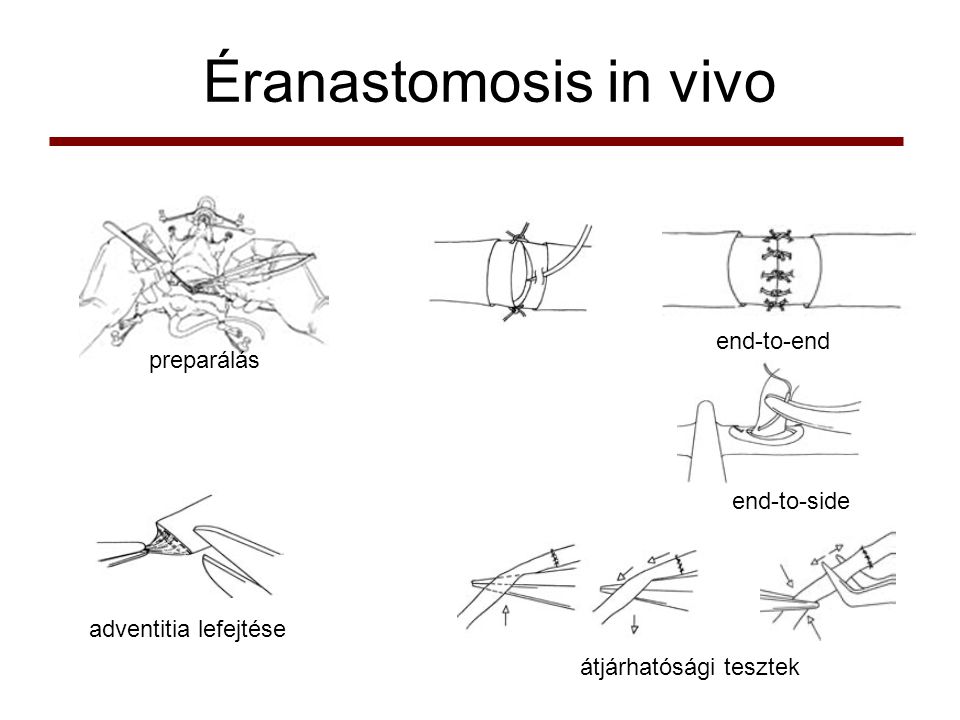 Éranastomosis in vivo end-to-end preparálás end-to-side