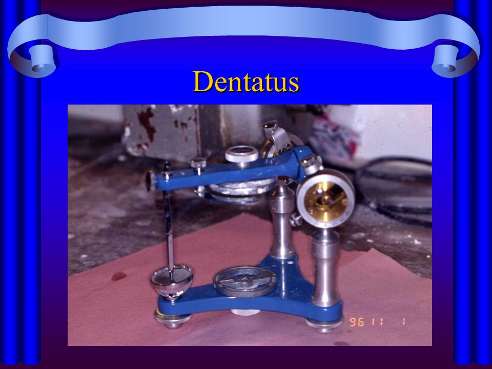 Dentatus