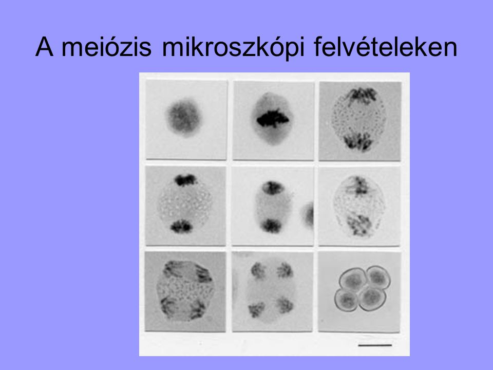 A meiózis mikroszkópi felvételeken