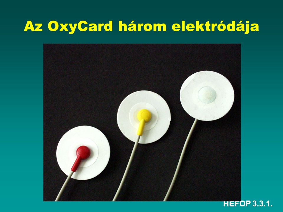 Az OxyCard három elektródája