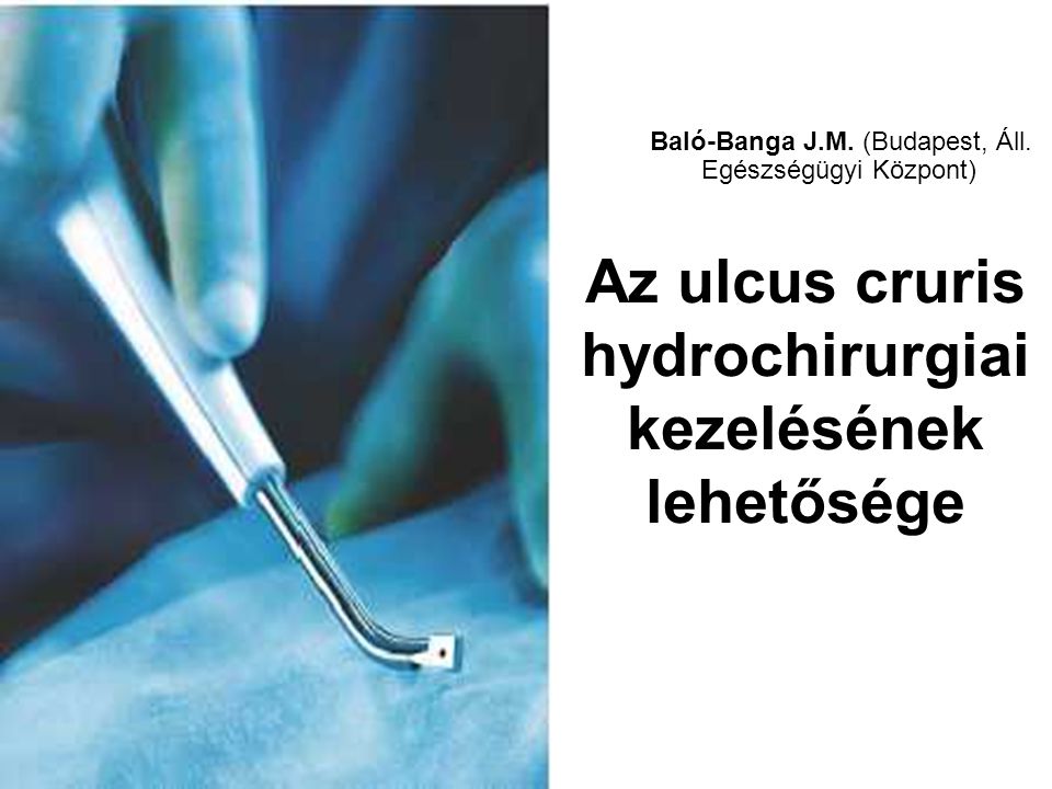 Az ulcus cruris hydrochirurgiai kezelésének lehetősége