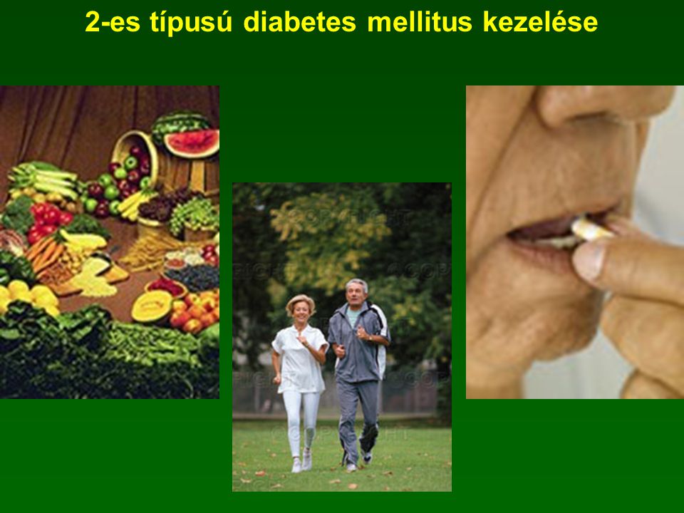 2-es típusú diabetes mellitus kezelése