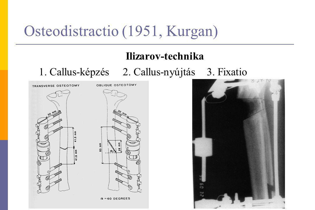 Osteodistractio (1951, Kurgan)