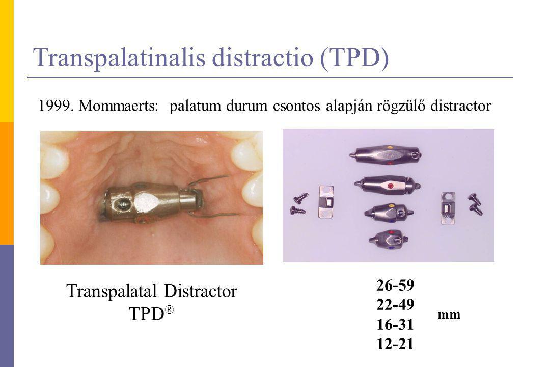 Transpalatinalis distractio (TPD)