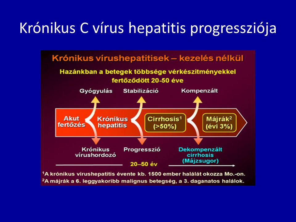 Krónikus C vírus hepatitis progressziója