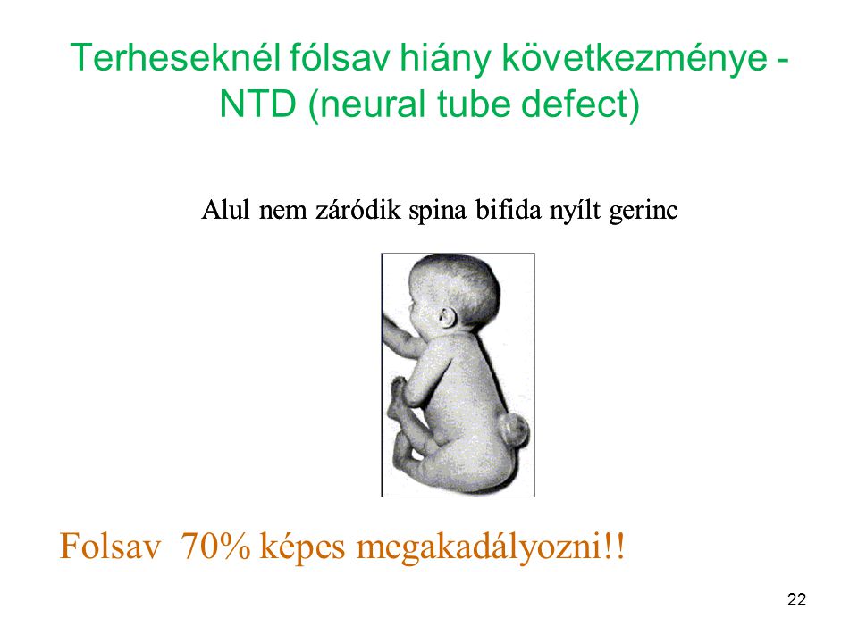 Terheseknél fólsav hiány következménye - NTD (neural tube defect)
