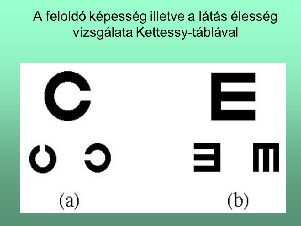 A feloldó képesség illetve a látás élesség vizsgálata Kettessy-táblával