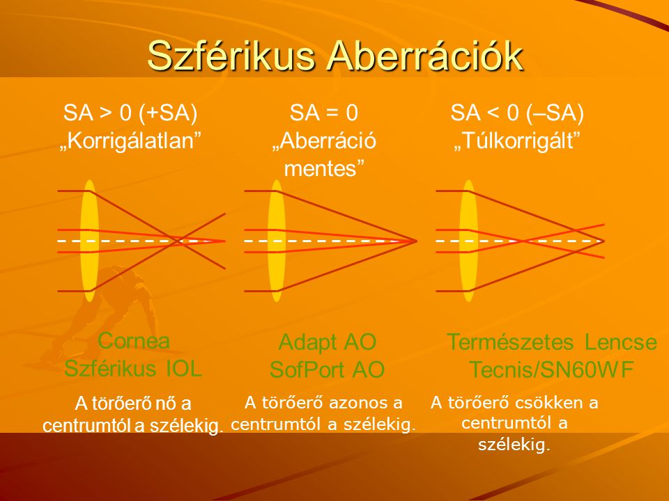 Szférikus Aberrációk SA > 0 (+SA) „Korrigálatlan SA = 0