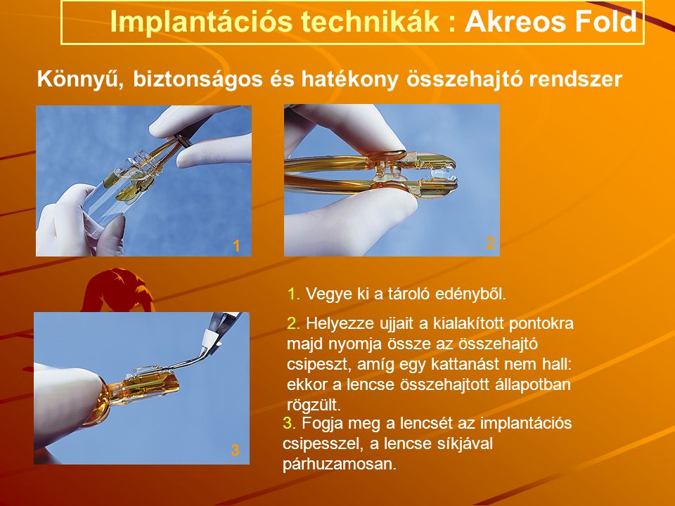 Implantációs technikák : Akreos Fold