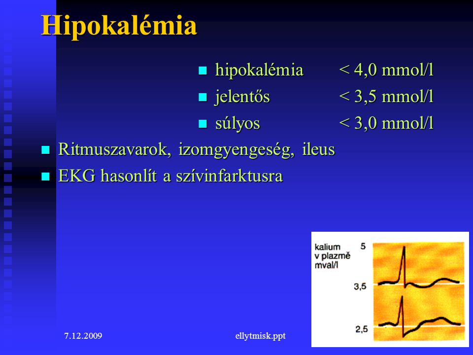 Hipokalémia hipokalémia < 4,0 mmol/l jelentős < 3,5 mmol/l