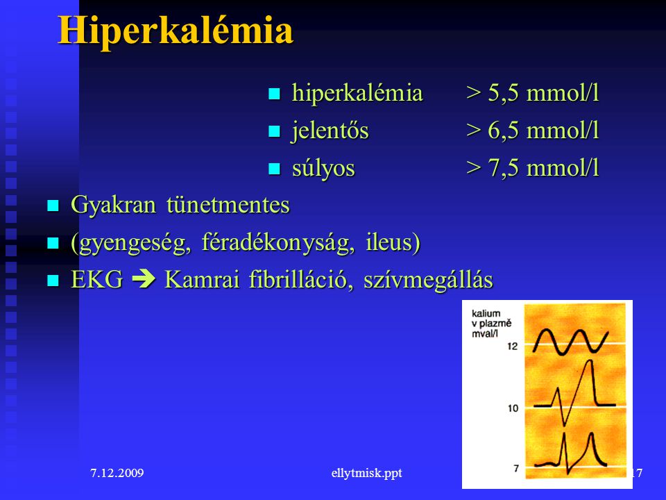 Hiperkalémia hiperkalémia > 5,5 mmol/l jelentős > 6,5 mmol/l