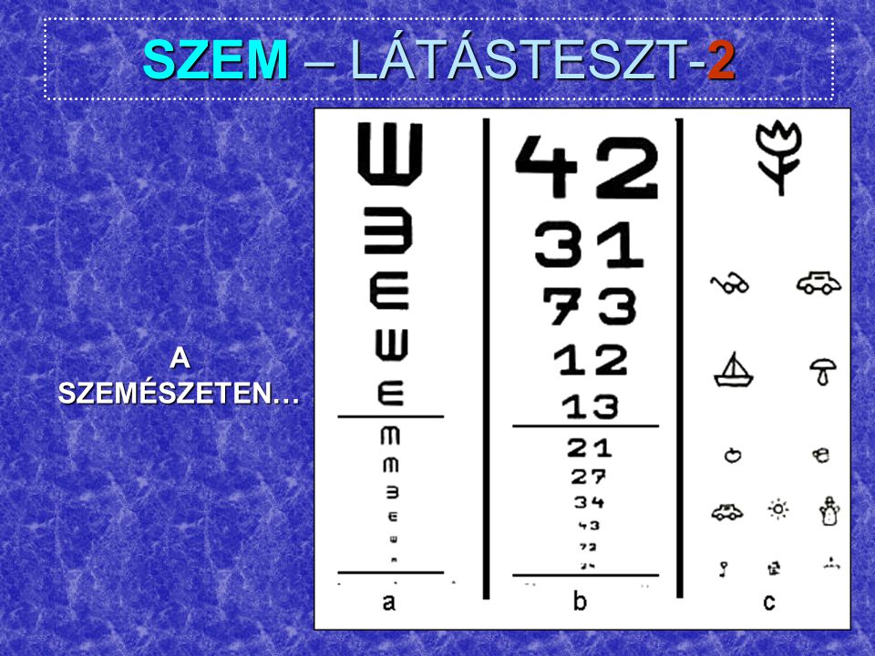 SZEM – LÁTÁSTESZT-2 A SZEMÉSZETEN…