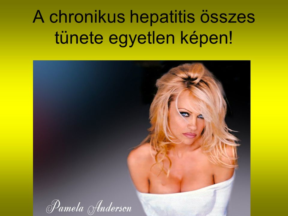 A chronikus hepatitis összes tünete egyetlen képen!