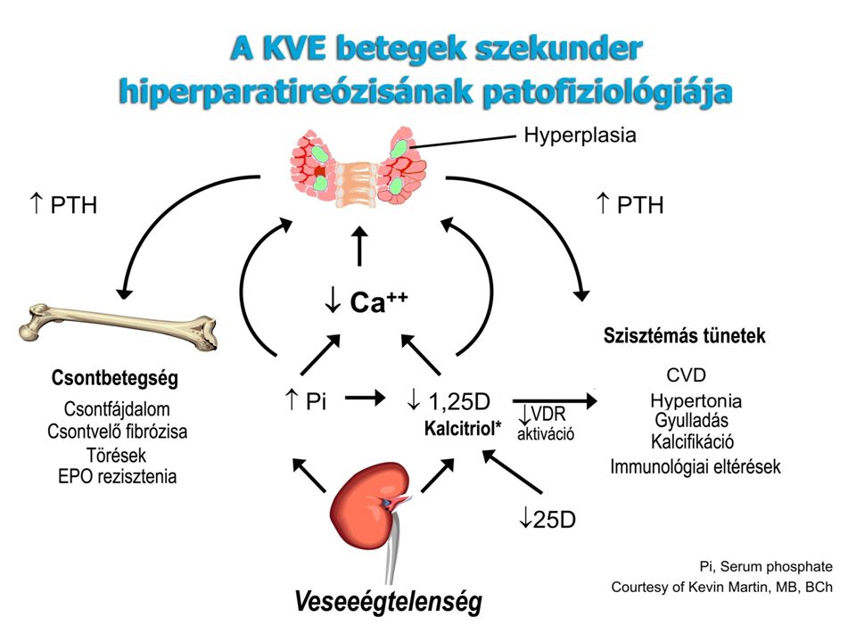 A kalcitriol szint csökkenésének okai KVE-ben