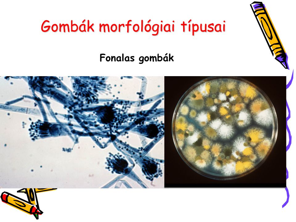 Gombák morfológiai típusai